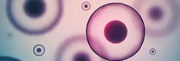 25770 - teaser 12