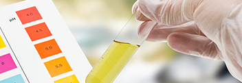 Chromatography